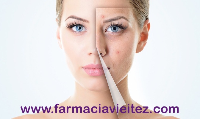 Usa nuestra cosmética propia pata el tratamiento acné y piel grasa