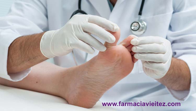 El tratamiento para los hongos de los pies es eficaz si se sigue habitualmente. Tratamiento hongos en los pies