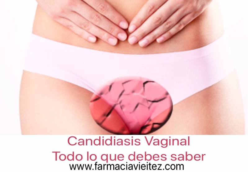 Hongos y Candidiasis vaginal | causas, prevención y tratamiento